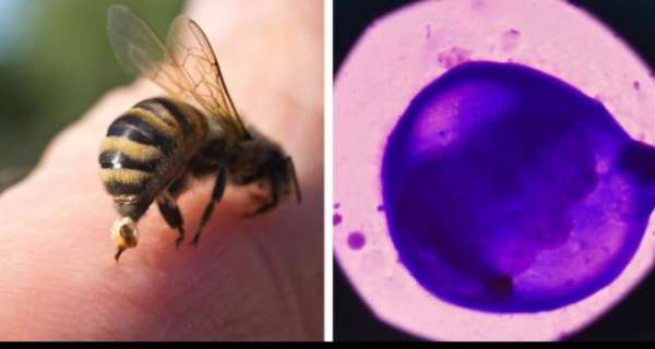 Honeybee Venom Induces 100% Breast Cancer Cell Death Image